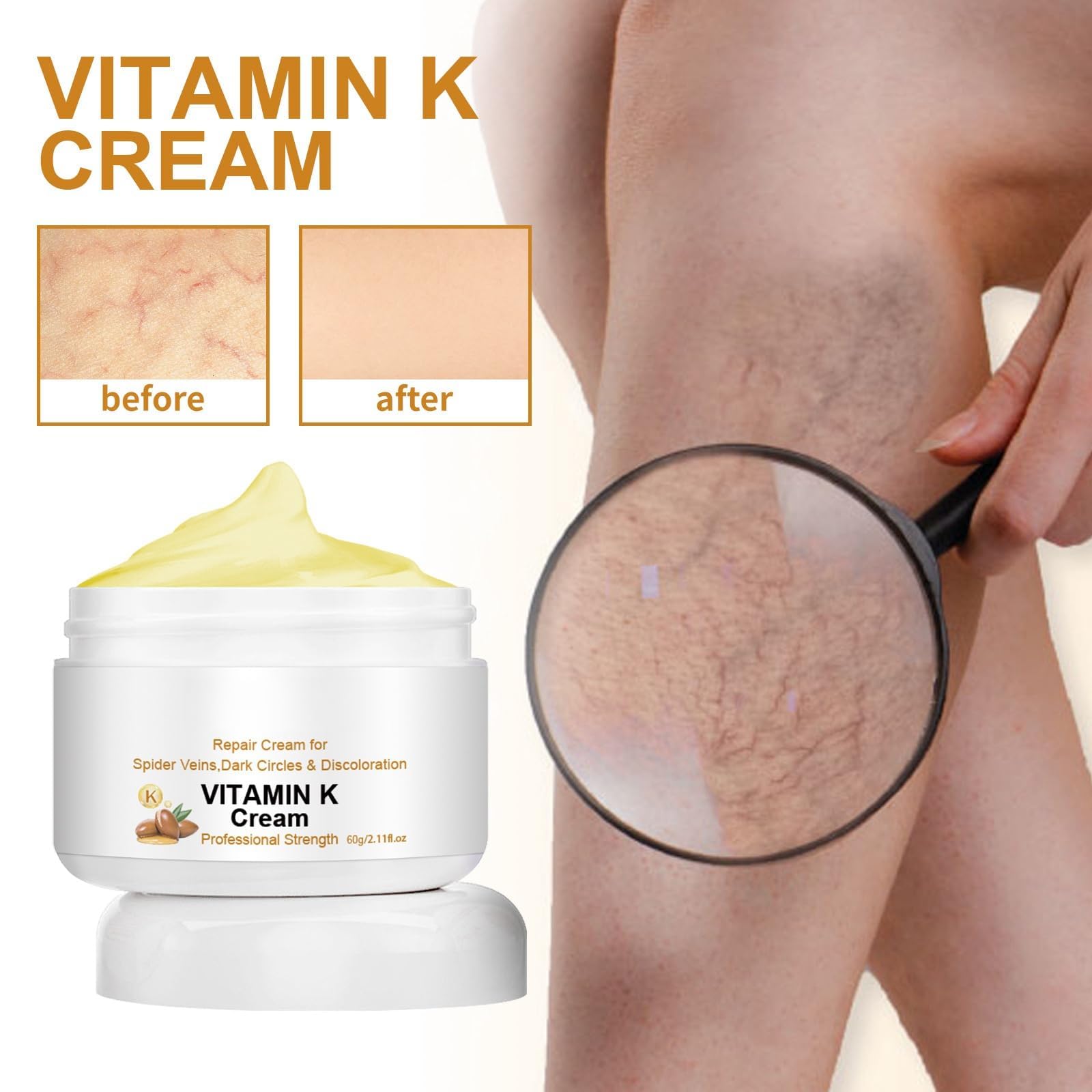 Best Varicose Veins Repair Cream with Vitamin K - Leg Vein Treatment for Men & Women - Soothing Relief for Spider Veins & Swollen Legs - Perfect for Daily Use at Home, Work or Travel