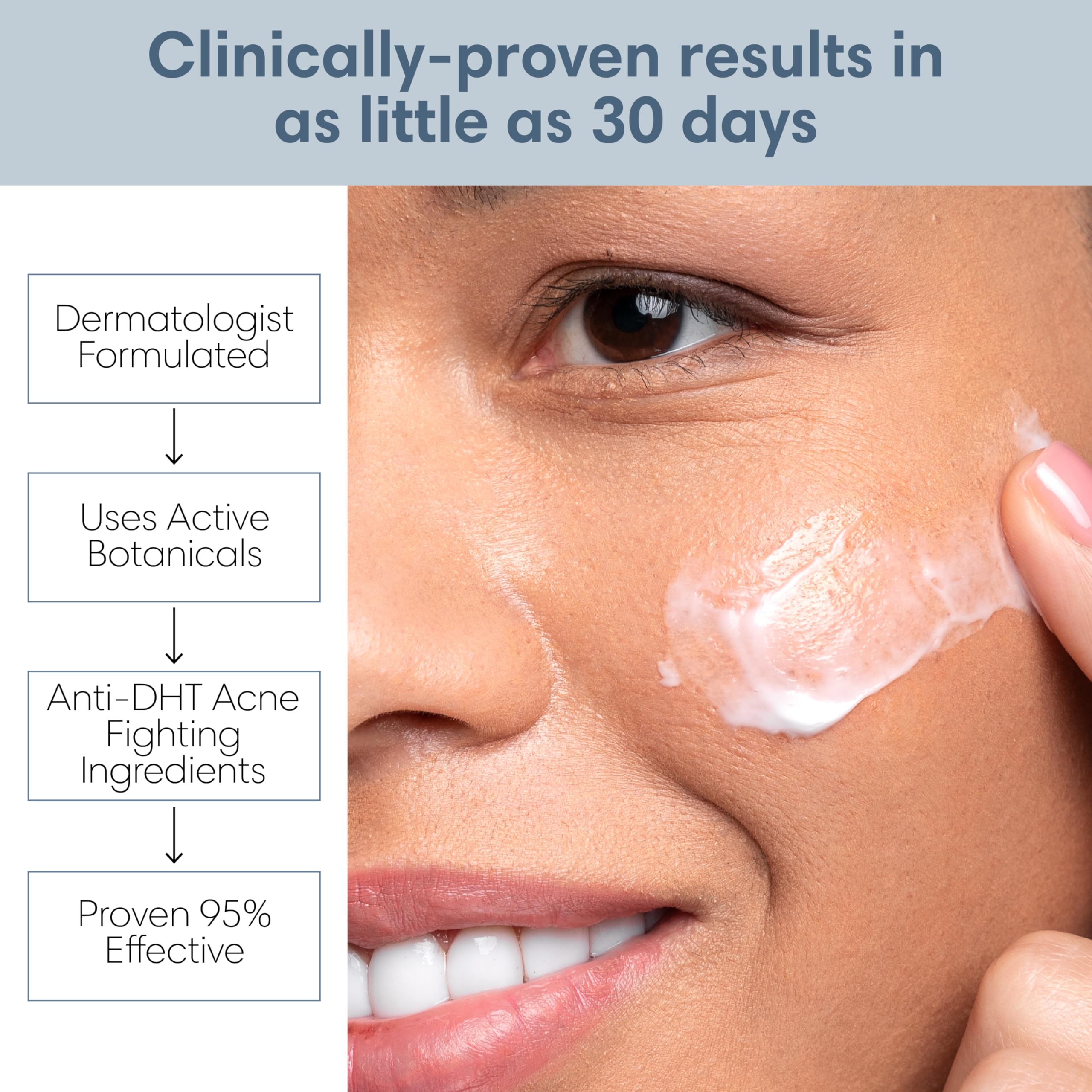**Sensitive Skin Sulfur Acne Treatment Lotion - 1.8 FL Oz | Sulfur Cream & Ointment for Acne & Spot Treatment | Gentle for Face & Body | Perfect for Oily & Breakout-Prone Skin**