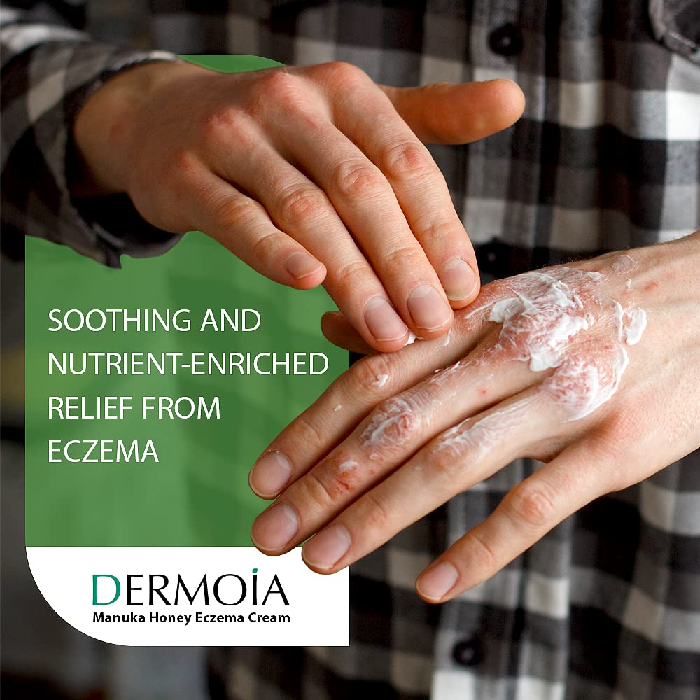 Manuka Honey Cream for Eczema & Dermatitis Relief - 4oz - Soothes Itchy Skin for Adults & Kids