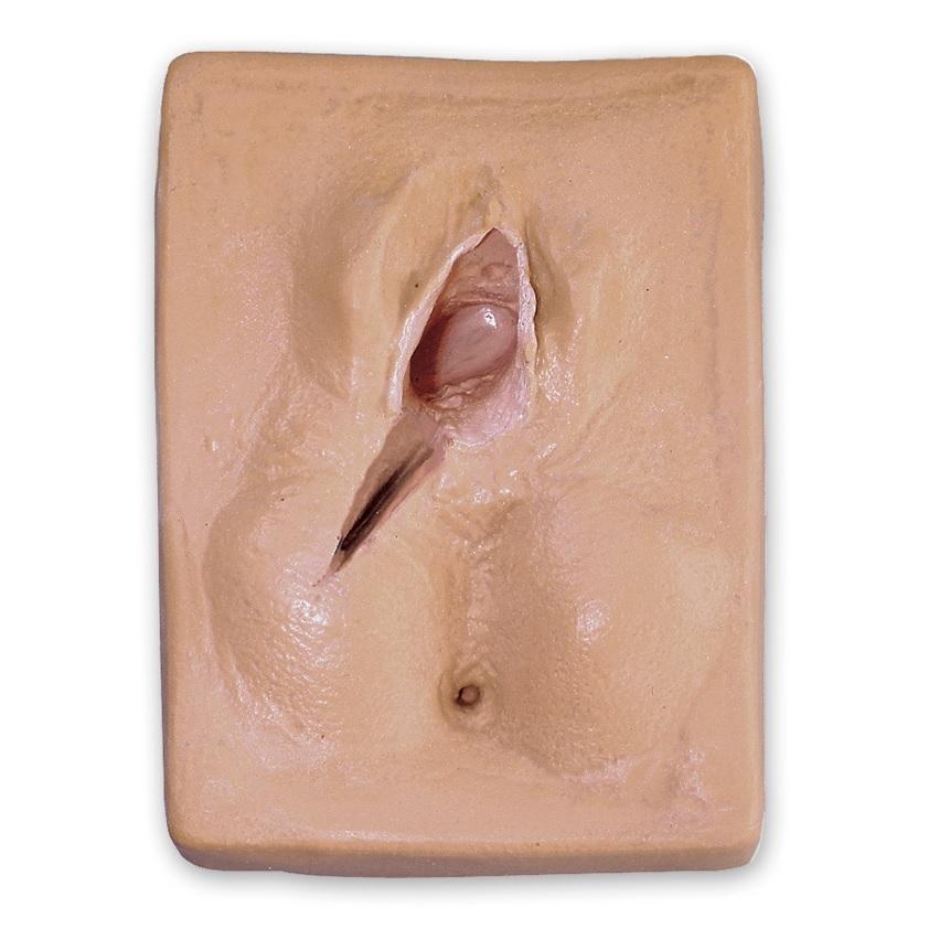 Episiotomy Right Mediolateral Suture Simulator - Medical Training Model for OBGYN Procedures, Childbirth Education & Surgical Practice - Perfect for Nursing Students, Midwives & Healthcare Professionals