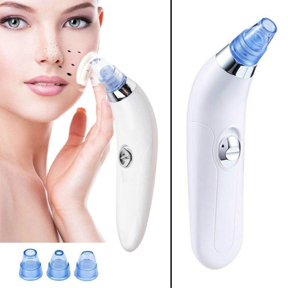 Viulvuk 4-in-1 Electric Blackhead & Whitehead Remover Tool - Professional Derma Suction Machine for Acne, Pimple & Pore Cleaning - Facial Cleansing Device for Face, Nose & Skin Care - Perfect for Home Spa & Skincare Routine