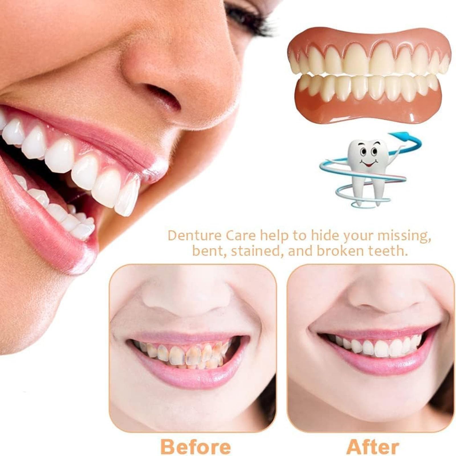 Yunpso Denture Silicone Reline Kit - Natural & Comfortable Teeth Veneers for Men & Women (1 Set) | Perfect for Denture Adjustments, Comfort Enhancement & Daily Wear