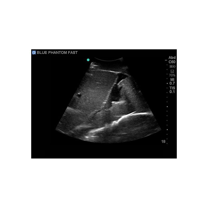 FAST Exam Ultrasound Training Model - Transthoracic & Transesophageal Echo Simulator for Cardiac Sonography Practice (Ideal for Medical Students, Ultrasound Tech Training & Clinical Skills Development)