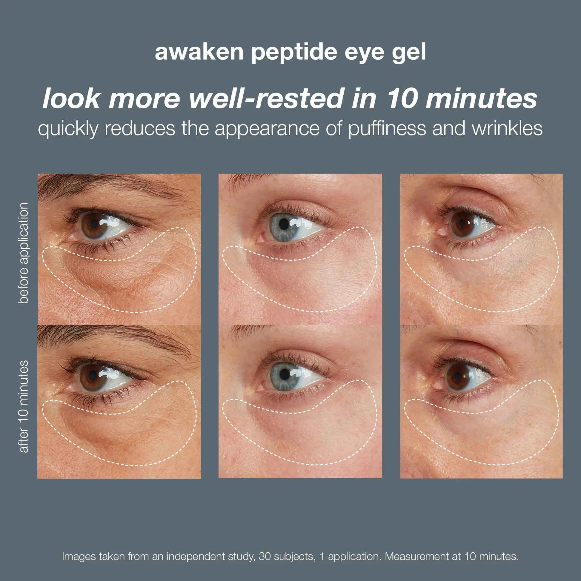 Awaken Peptide Eye Gel - Anti-Aging & Hydrating Under Eye Treatment for Dark Circles & Puffiness | Perfect for Morning Routine & Night Skincare