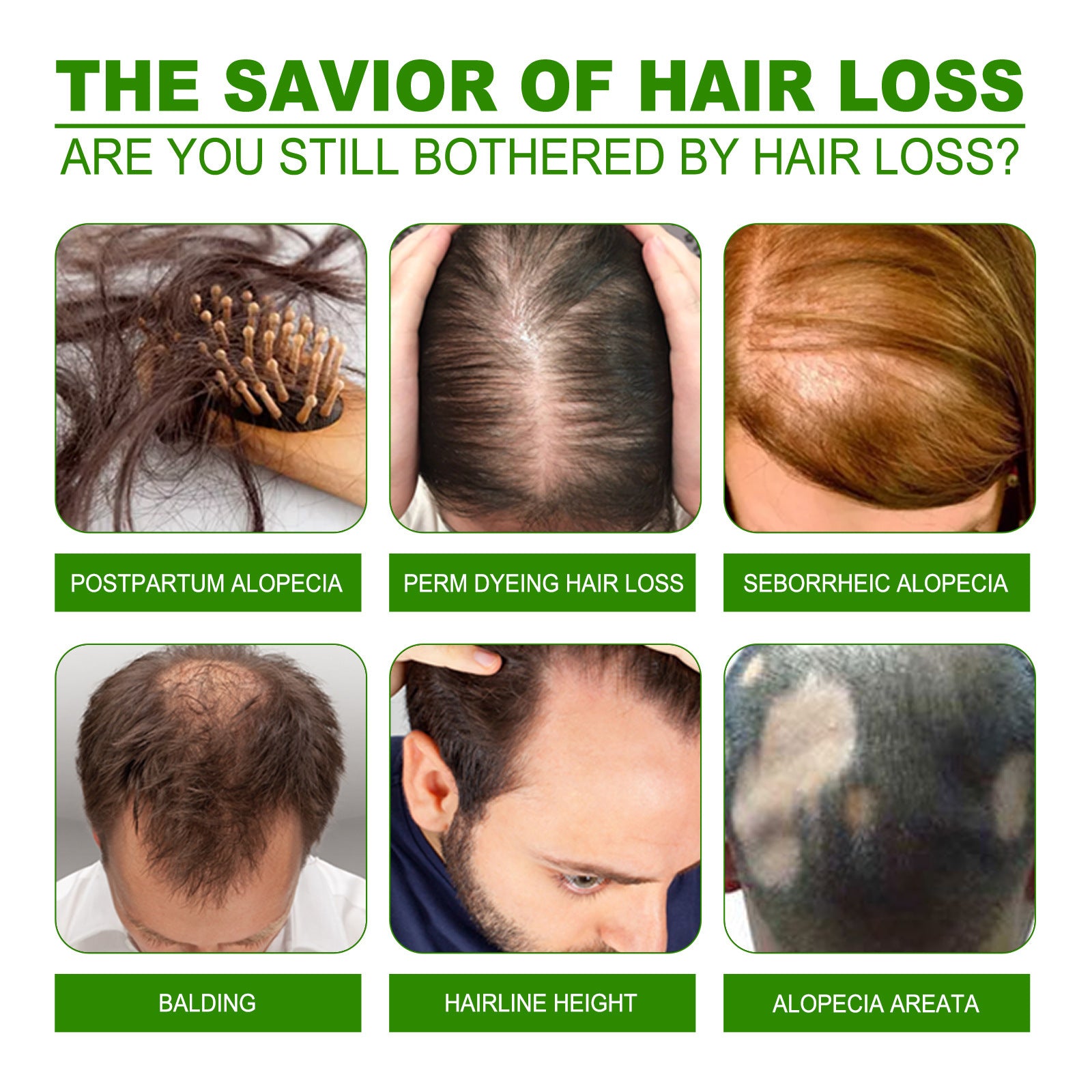 Hair Growth Lotion Spray for Thicker, Longer Hair - Nourishing Treatment for Hair Loss Prevention & Scalp Care - Perfect for Daily Use at Home or Salon