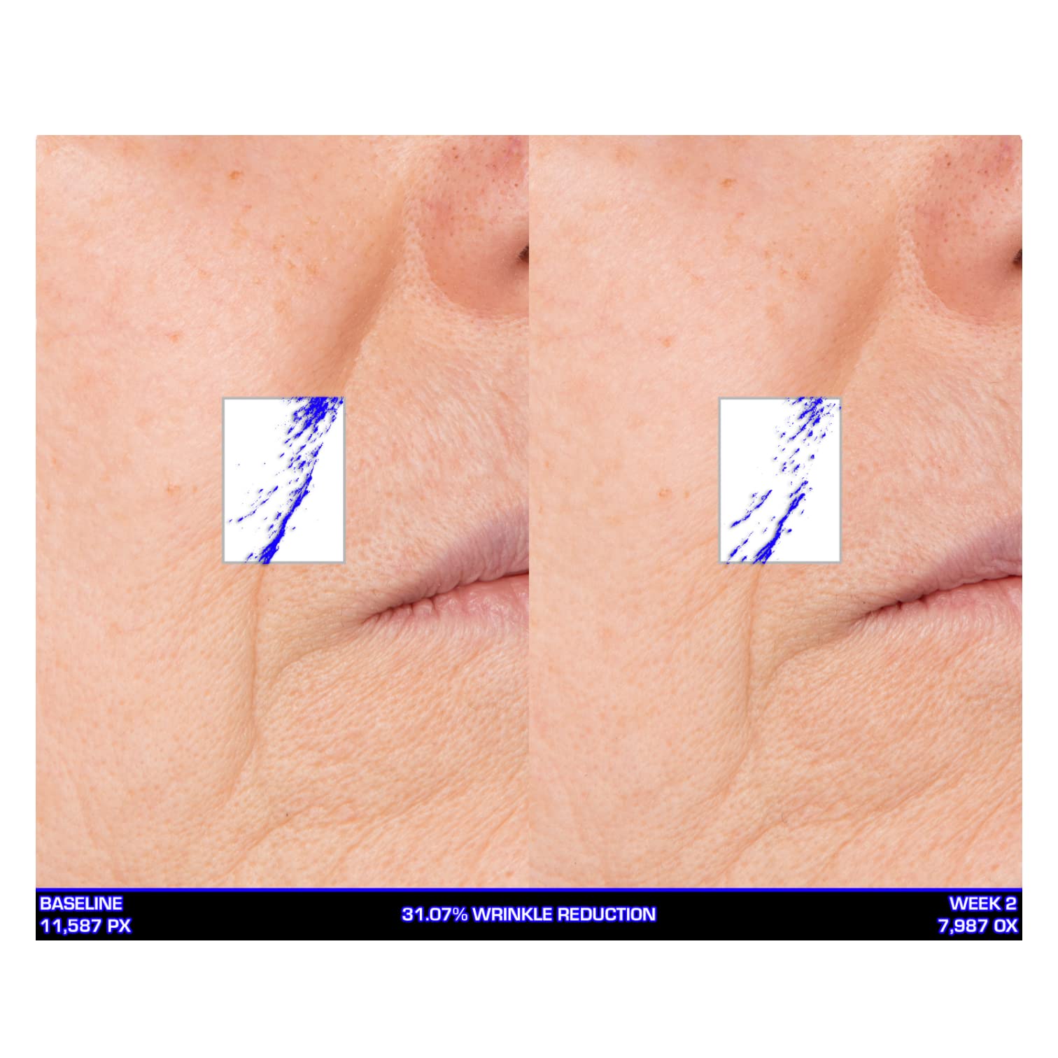 Serious Skincare Ultra-Mare Pure Marine Infusion Facial Serum - Collagen Boosting, Cell Renewal & Plumping Serum with Niacinamide, Acid-Free Formula (2 oz) - Perfect for Nighttime Skincare Routine & Anti-Aging Regimen