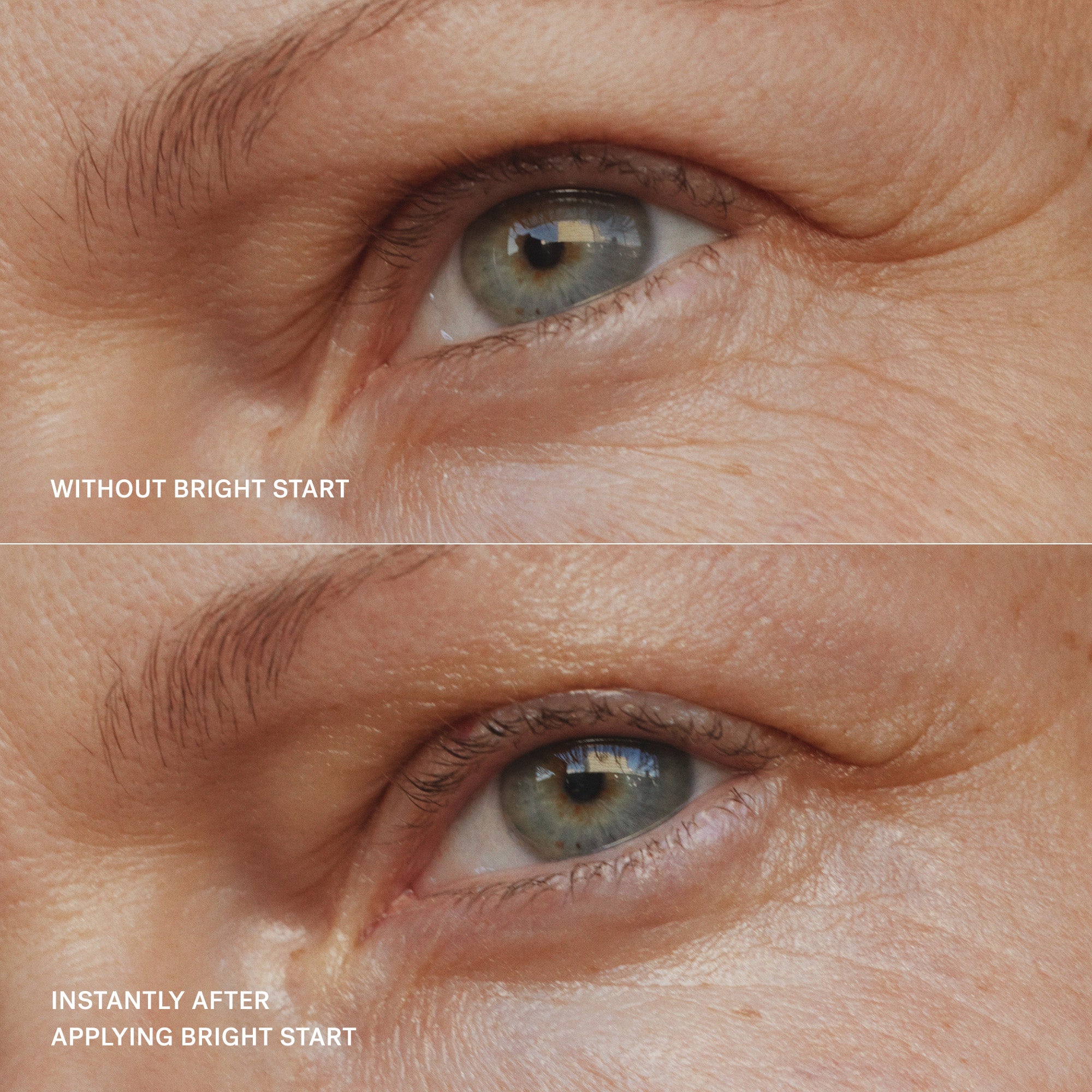 Bright Start Activated Eye Cream for Dark Circles & Wrinkles - Anti-Aging Eye Treatment for Puffiness & Fine Lines - Perfect for Morning & Night Skincare Routine