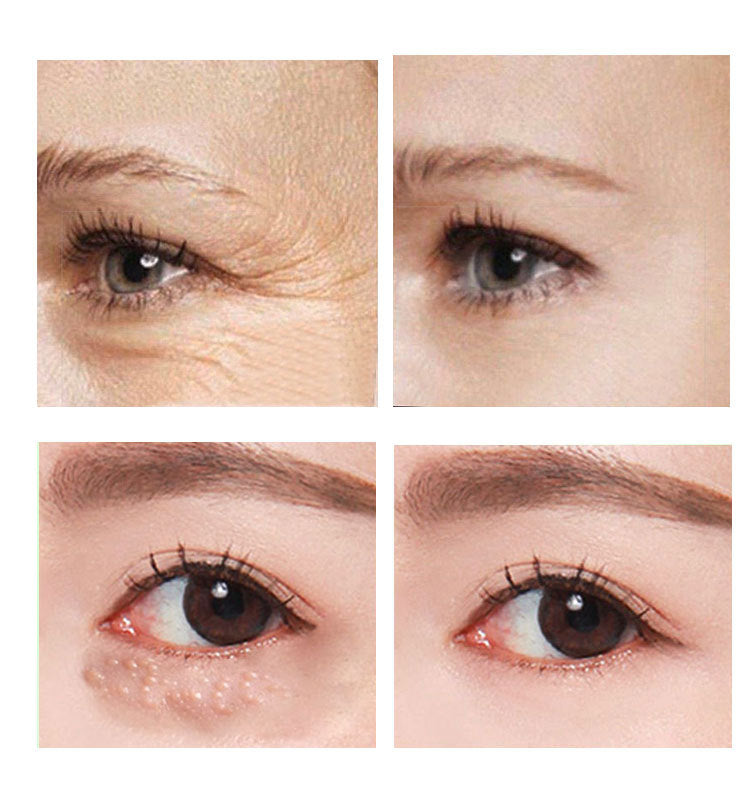 30ml Anti-Aging Eye Cream for Women - Dark Circle & Wrinkle Treatment - Hydrating Under Eye Cream for Night & Day Use - Perfect for Daily Skincare Routine