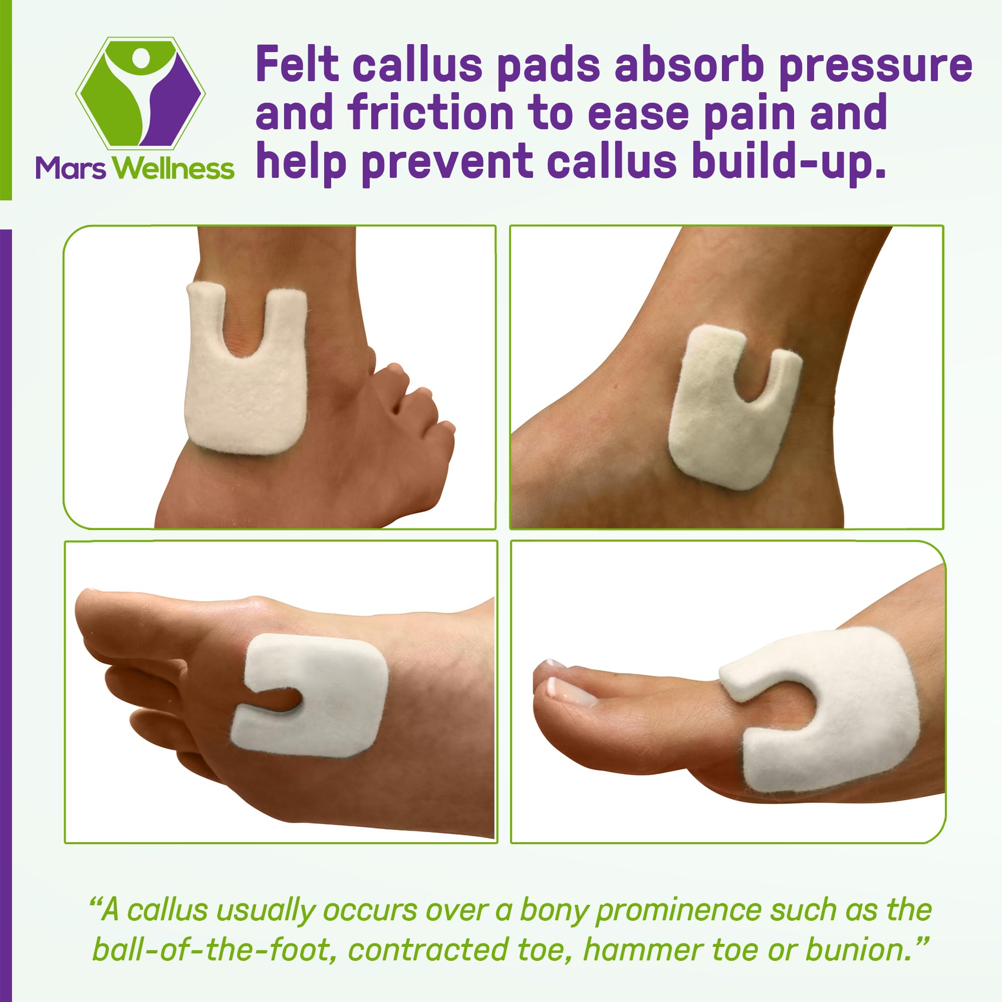 Wide U-Shaped Felt Callus Horseshoe Pads - 25 Pack Adhesive Foot Cushions for Corn & Callus Protection (1/4