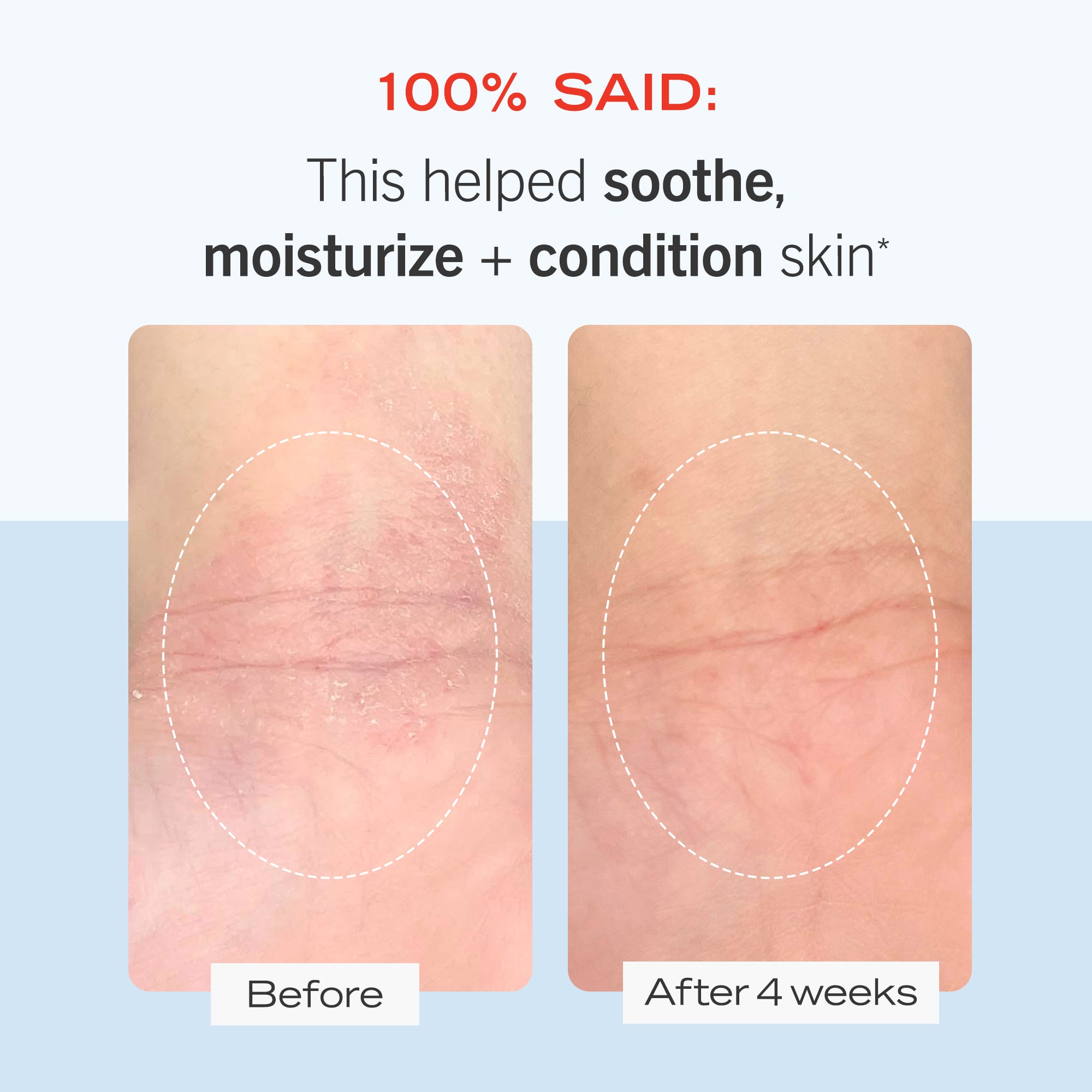 Gentle Skincare Starter Kit for Sensitive Skin - Soothe & Hydrate Dry, Irritated Skin - Perfect for Daily Cleansing & Moisturizing Routine