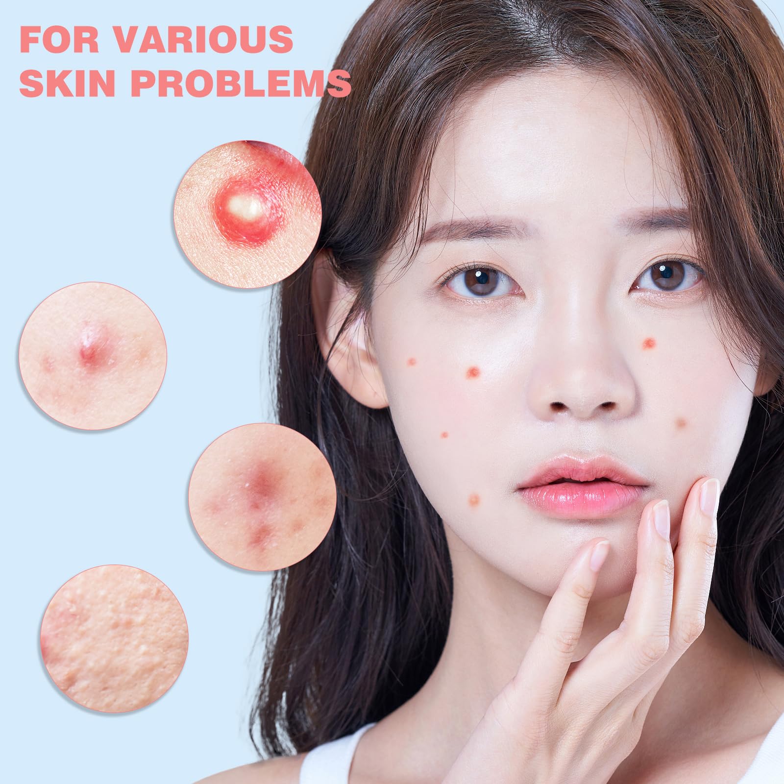 280PCS Hydrocolloid Acne Patches for Face - Star Shaped Pimple Patches to Cover Zits & Blemishes | Gentle Facial Skin Care Treatment for Overnight Spot Healing | Perfect for Teens & Adults with Acne-Prone Skin