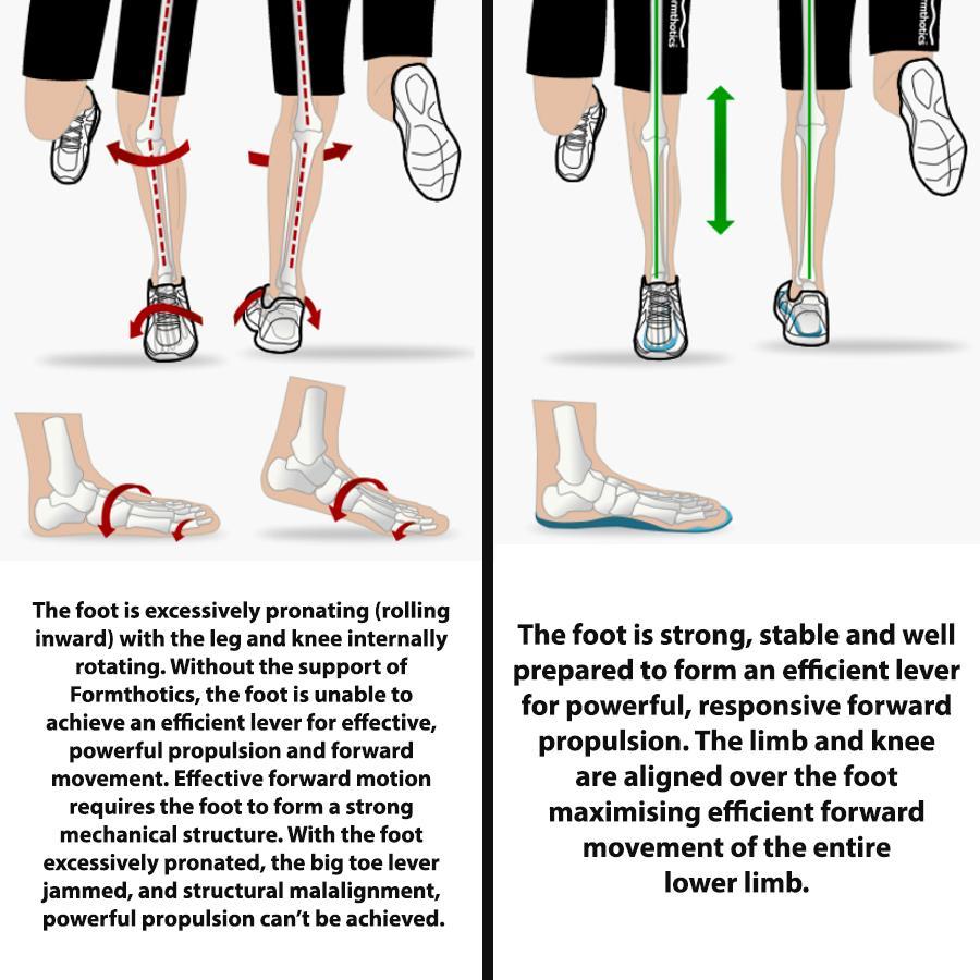 Formthotics Run Dual Orthotics - Premium Running Shoe Insoles for Arch Support & Pain Relief - Ideal for Jogging, Walking & Sports Activities