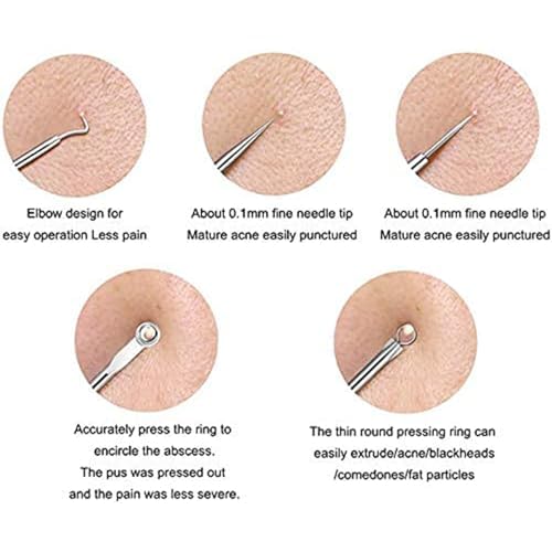 AJICA Professional Blackhead Remover Kit - 4 Piece Stainless Steel Comedone Extractor & Acne Tweezers Set for Facial Blemish Removal - Perfect for Home Skincare & Spa Treatments