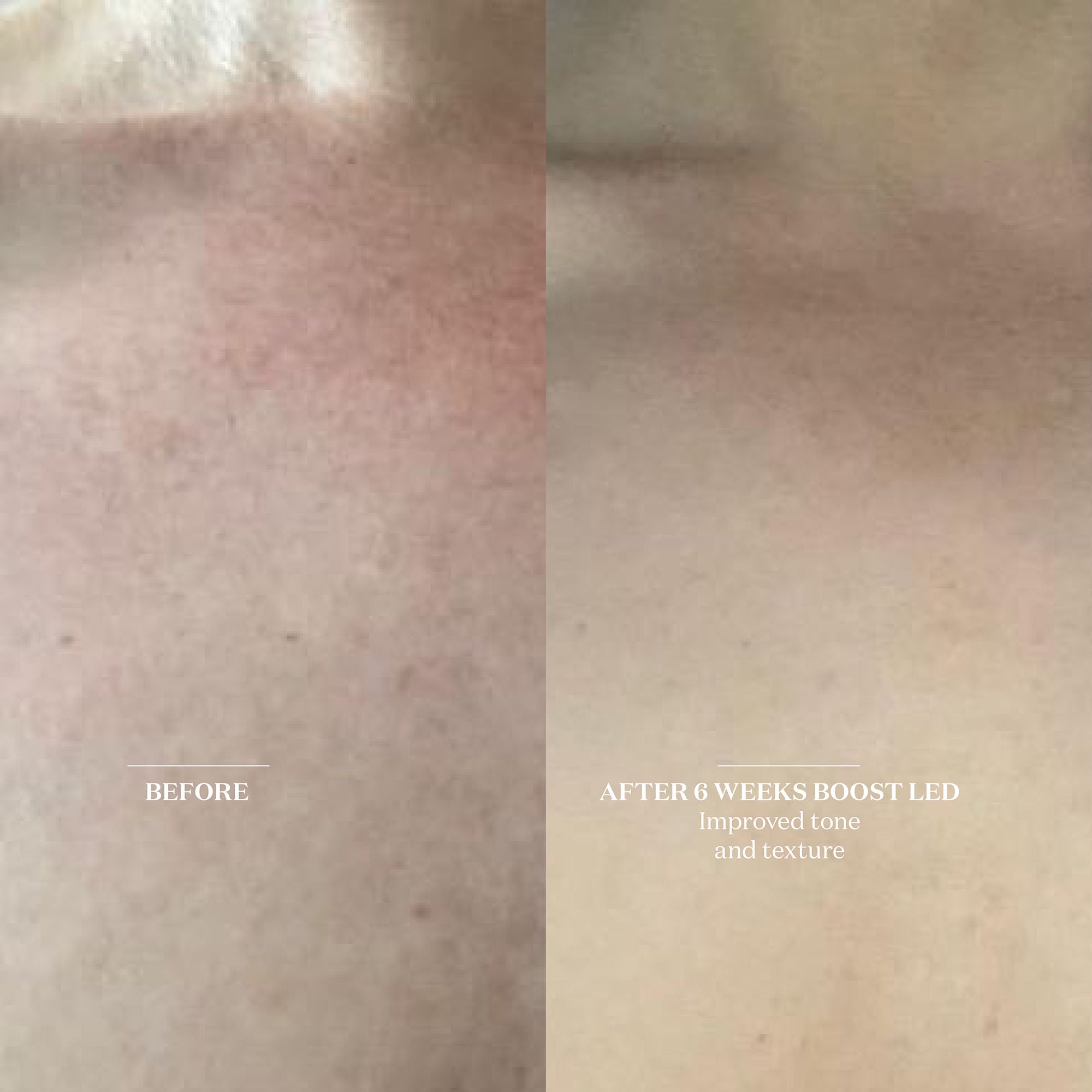 The Light Salon Boost LED Face Mask for Skin Rejuvenation - Red Light Therapy for Anti-Aging & Acne Treatment - Perfect for At-Home Skincare Routine & Spa Treatments