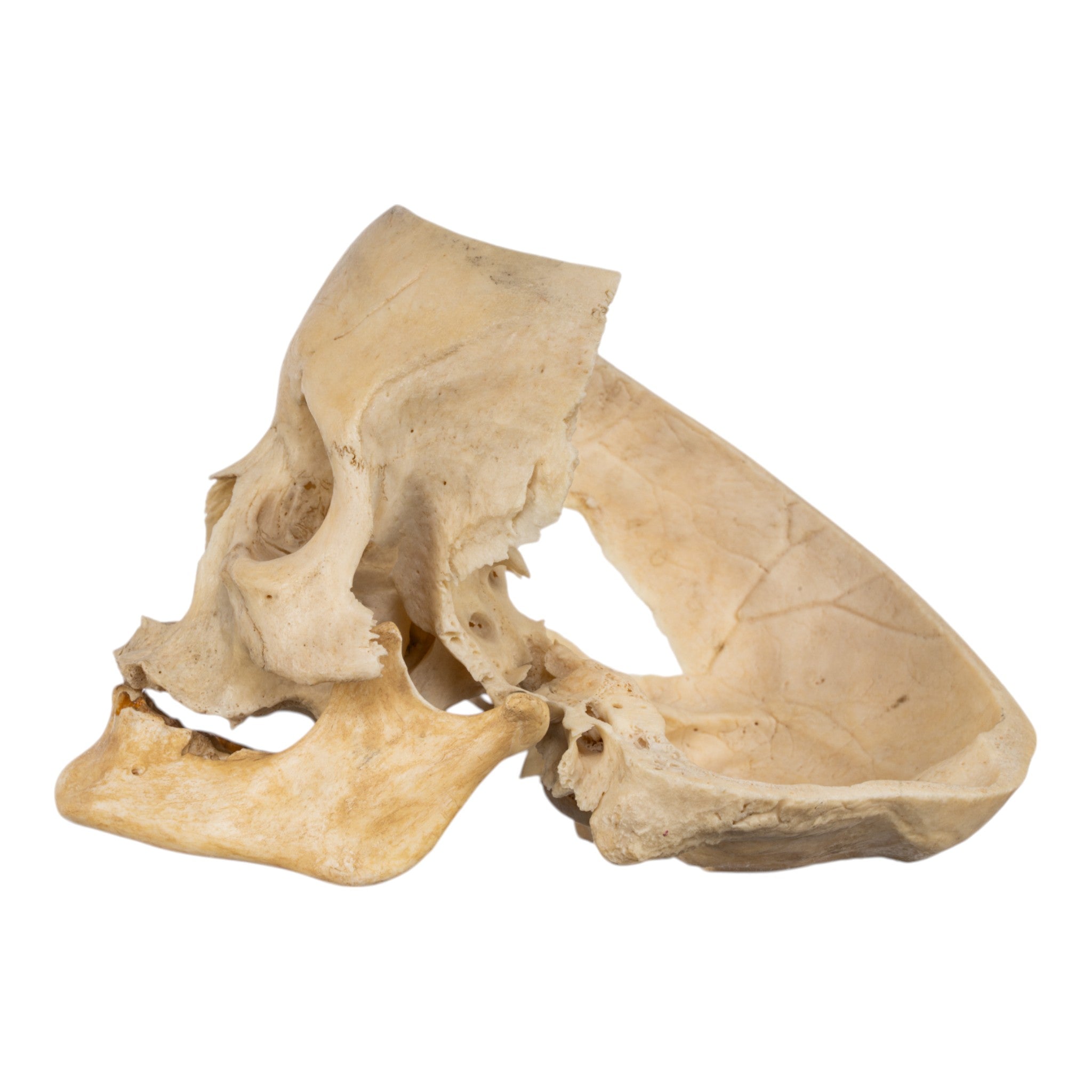 Real Human Skull Partial - Authentic Medical Specimen for Anatomy Study, Halloween Decor & Gothic Collectibles