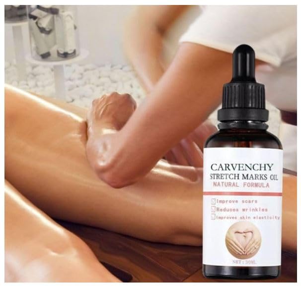 Ramley Stretch Marks Oil for Women - 30ML | Pregnancy Safe, Deep Moisturizing & Skin Repair for Radiant Look | Perfect for Pre & Postpartum Care, Daily Hydration & Stretch Mark Prevention