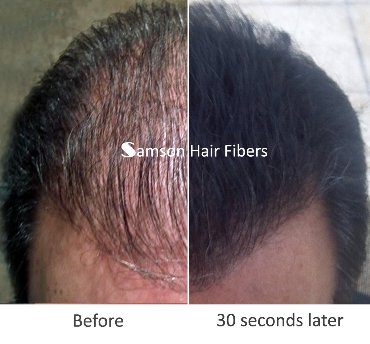 Best Hair Loss Concealer & Thickening Fibers - 1KG Black | USA Made for All Hair Types | Perfect for Thinning Hair, Bald Spots & Daily Styling