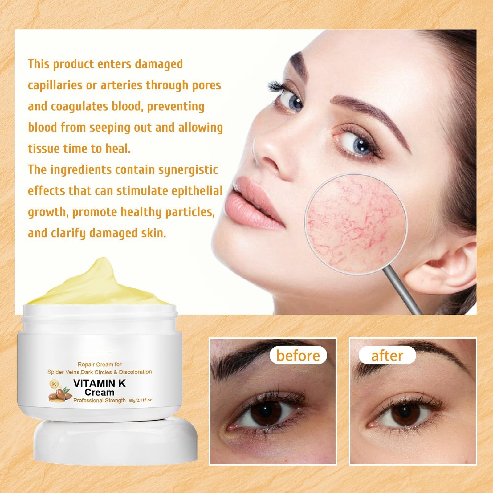 Best Varicose Veins Repair Cream with Vitamin K - Leg Vein Treatment for Men & Women - Soothing Relief for Spider Veins & Swollen Legs - Perfect for Daily Use at Home, Work or Travel