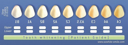 Professional 35% Teeth Whitening Gel - 8 Large 10ml Syringes (80ml Total) - Fast Acting Whitening Formula for Instant White Smiles - Perfect for Home Use, Dental Office & Special Occasions