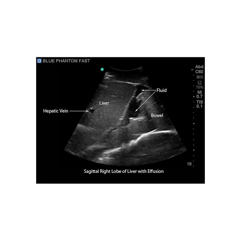 FAST Exam Ultrasound Training Model - Transthoracic & Transesophageal Echo Simulator for Cardiac Sonography Practice (Ideal for Medical Students, Ultrasound Tech Training & Clinical Skills Development)