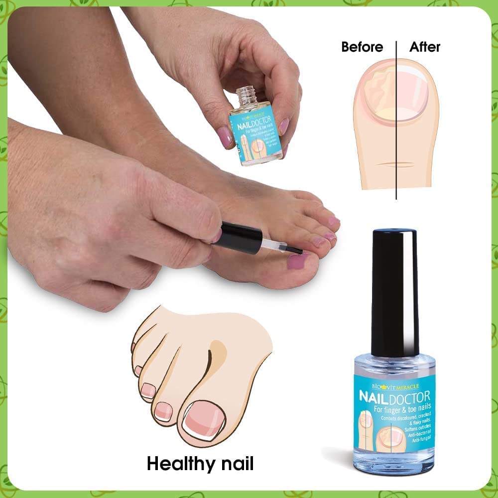 VYTALIVING BioClear Nail Doctor - Effective Ingrown Toenail & Fungal Nail Treatment | Fast-Acting Toenail Repair Solution | 15ml | Perfect for Athletes, Runners & Pedicure Care