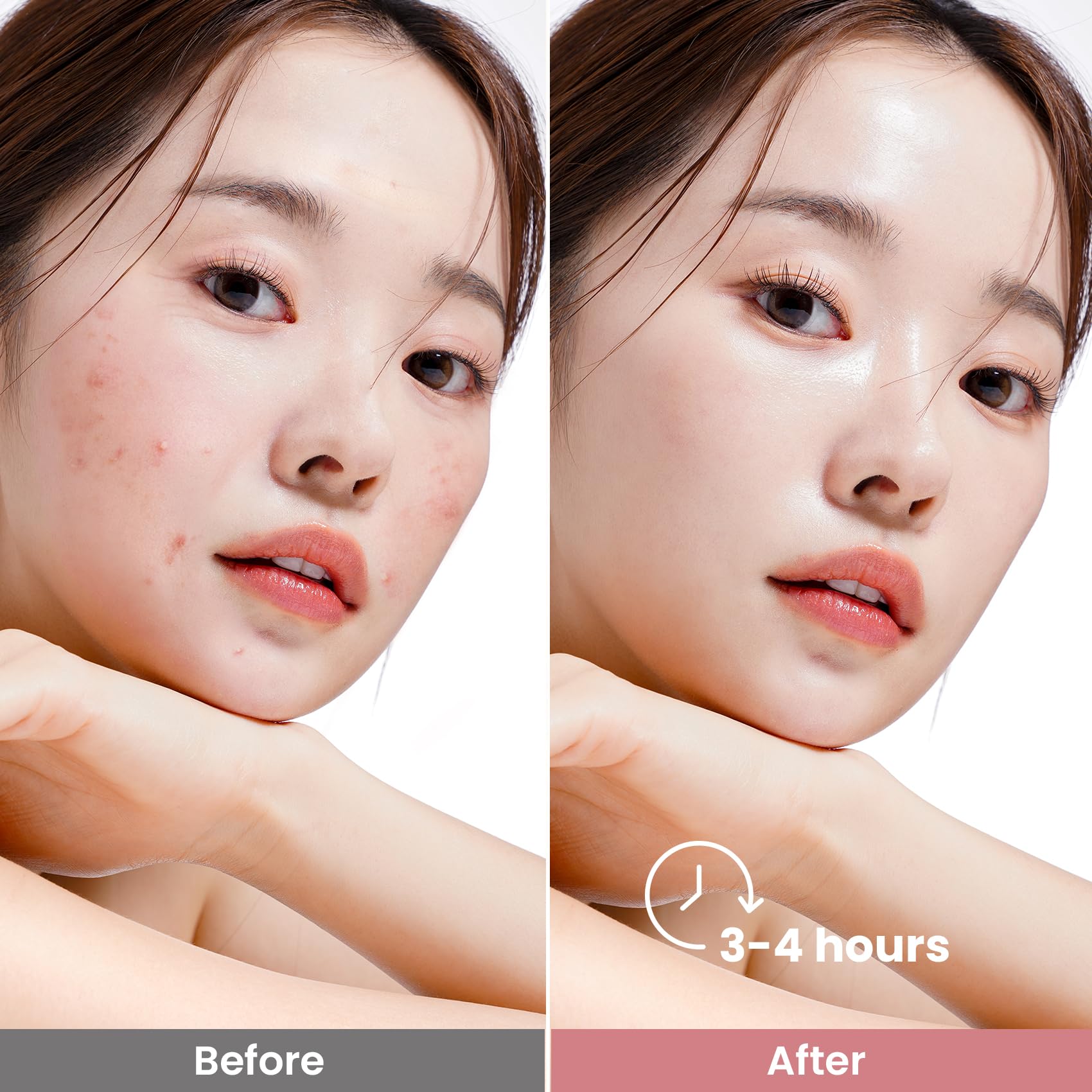 Elvira Glycolic Acid Exfoliating Facial Pads & Bio-Collagen Face Mask Set - Korean Skincare for Acne-Prone Skin, Deep Hydration & Brightening | Daily Exfoliating Treatment & Overnight Mask for Glowing Complexion | Perfect for Nighttime Routine & Pre-Makeup Prep