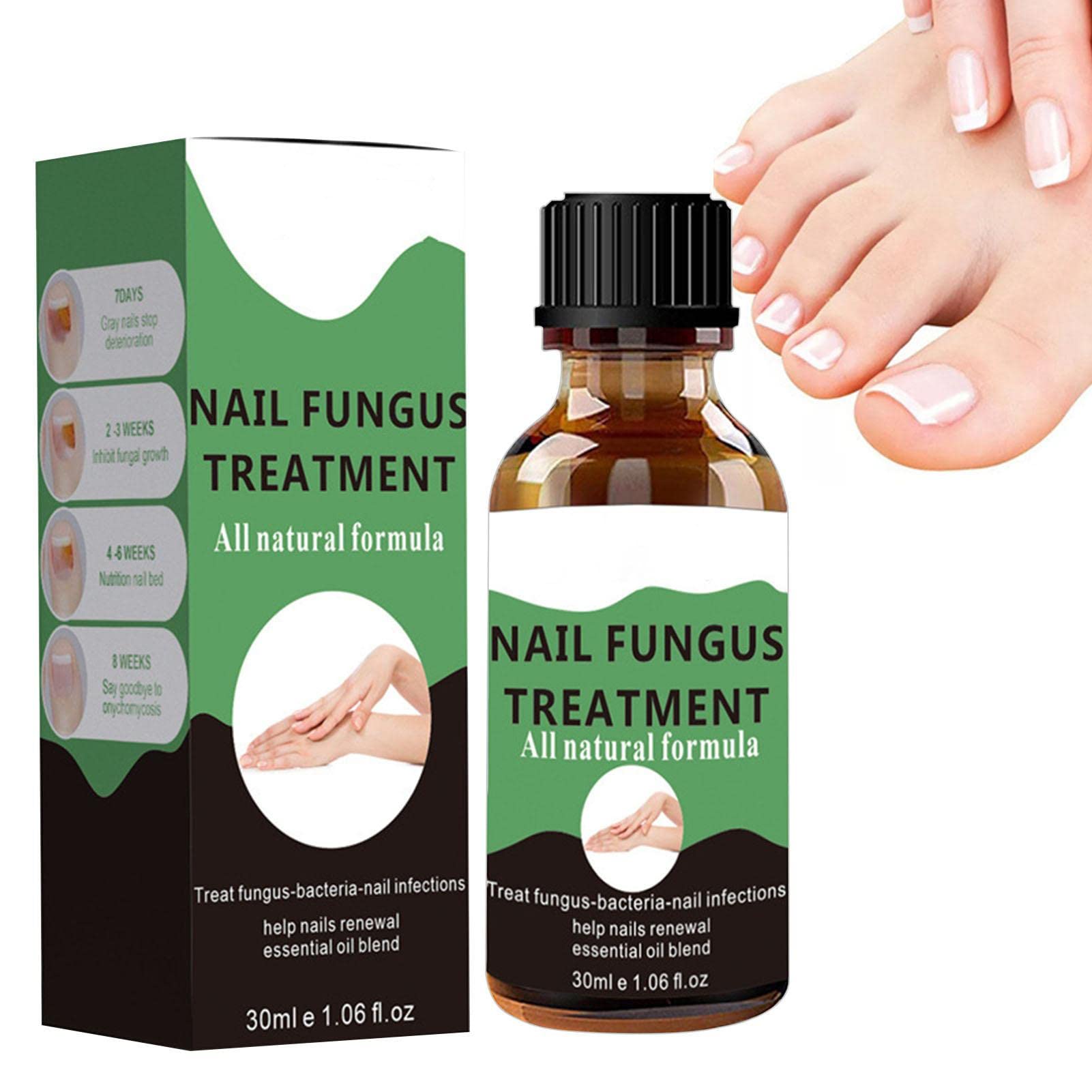 Bexdug Nail Repair Treatment - Strengthening Solution for Damaged, Cracked & Discolored Nails | Restores Healthy Toenails & Fingernails | Perfect for Fungal Infections, Brittle Nails & Nail Renewal | Home & Salon Use