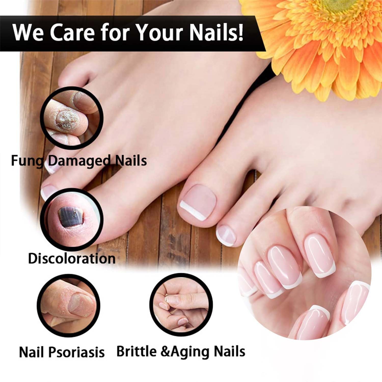 Postur Nail Gel - Fungus Treatment & Nail Care for Damaged & Discolored Nails - Strengthens & Restores Healthy Nails - Perfect for Toenail & Fingernail Fungus Treatment at Home (1pc)
