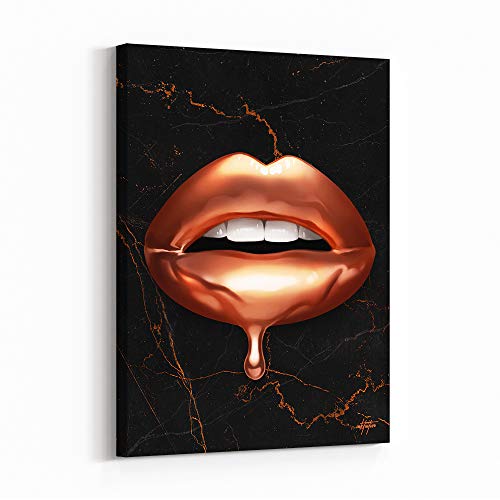 Royal Kiss