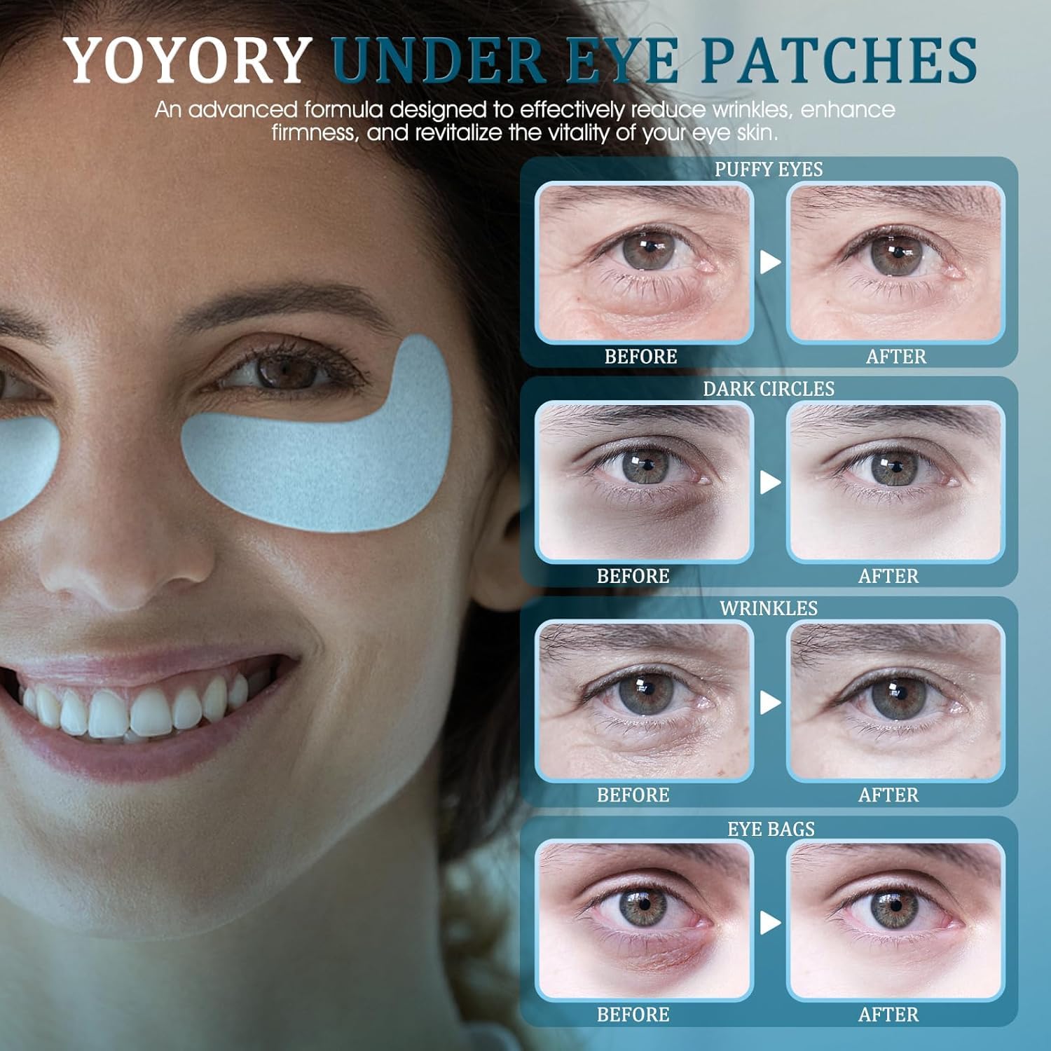 Under Eye Patches for Wrinkles & Dark Circles - Hydrating Eye Gel Masks with Hyaluronic Acid & Collagen | Puffy Eyes, Fine Lines & Eye Bags Treatment | 15 Pairs | Perfect for Night Routine & Travel Skincare