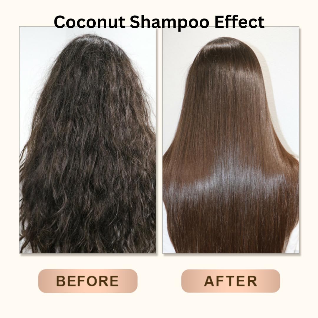 Organic Coconut Daily Hydration Shampoo & Conditioner Set - 17 fl oz Each - Sulfate Free, Paraben Free for Dry, Damaged Hair - Natural Hair Care with Coconut Oil - Perfect for Daily Use & Salon Quality Results at Home