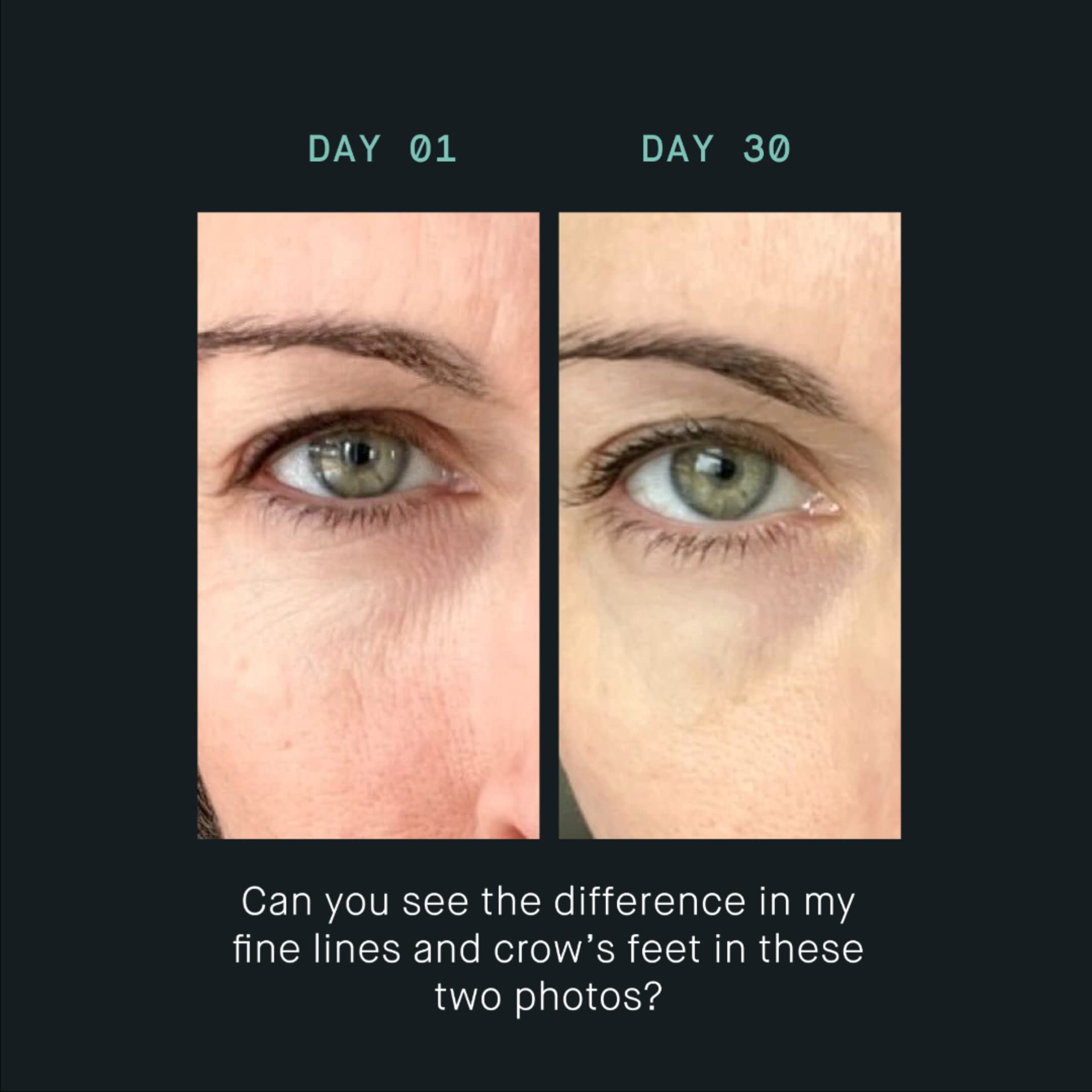 EYE OS-01 Peptide Eye Cream - Anti-Aging Topical Supplement for Wrinkles & Dark Circles | Skin Longevity & Age Reversal Treatment | Perfect for Night Routine & Daily Under Eye Care