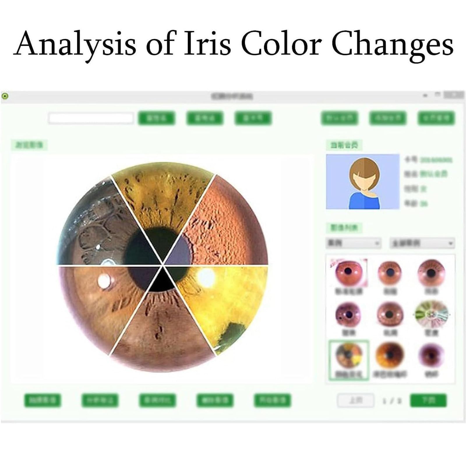 Professional Iridology Camera USB 2.0 with 30x Lens - Portable Left/Right Eye Analyzer for Holistic Health Assessment - Perfect for Naturopaths, Iridologists & Wellness Practitioners
