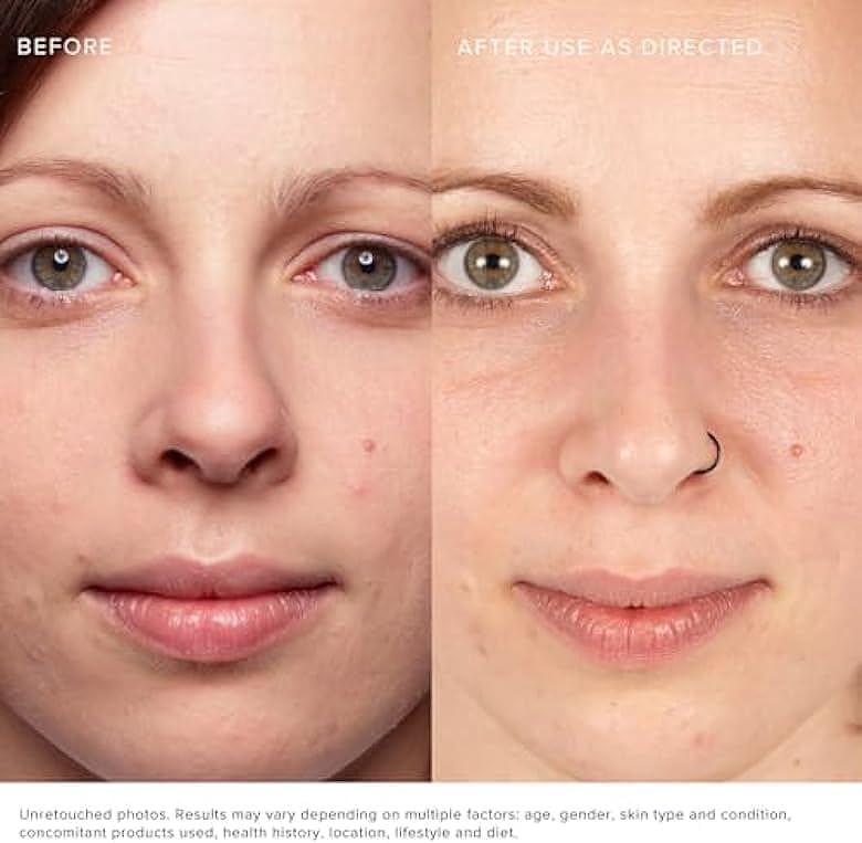 R+F Lash Boost Eyelash & Eyebrow Growth Serum - Enhance Longer, Stronger Lashes & Brows | For Daily Use & Special Occasions