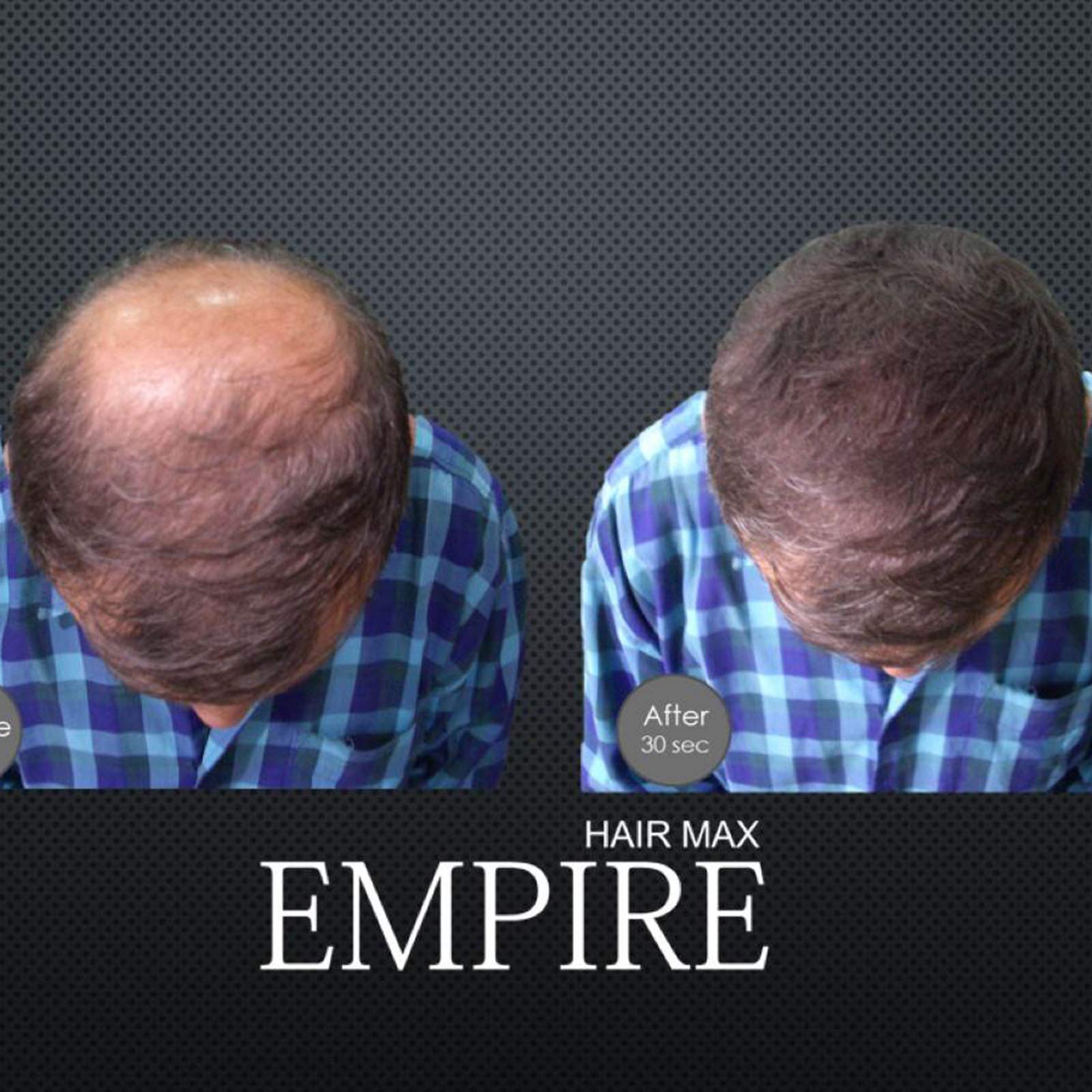 Empire Hair Max Hair Building Fibers - Thickening & Concealing Hair Loss Solution for Blonde Hair | Instant Volume Boost for Thin Hair, Daily Styling & Confidence