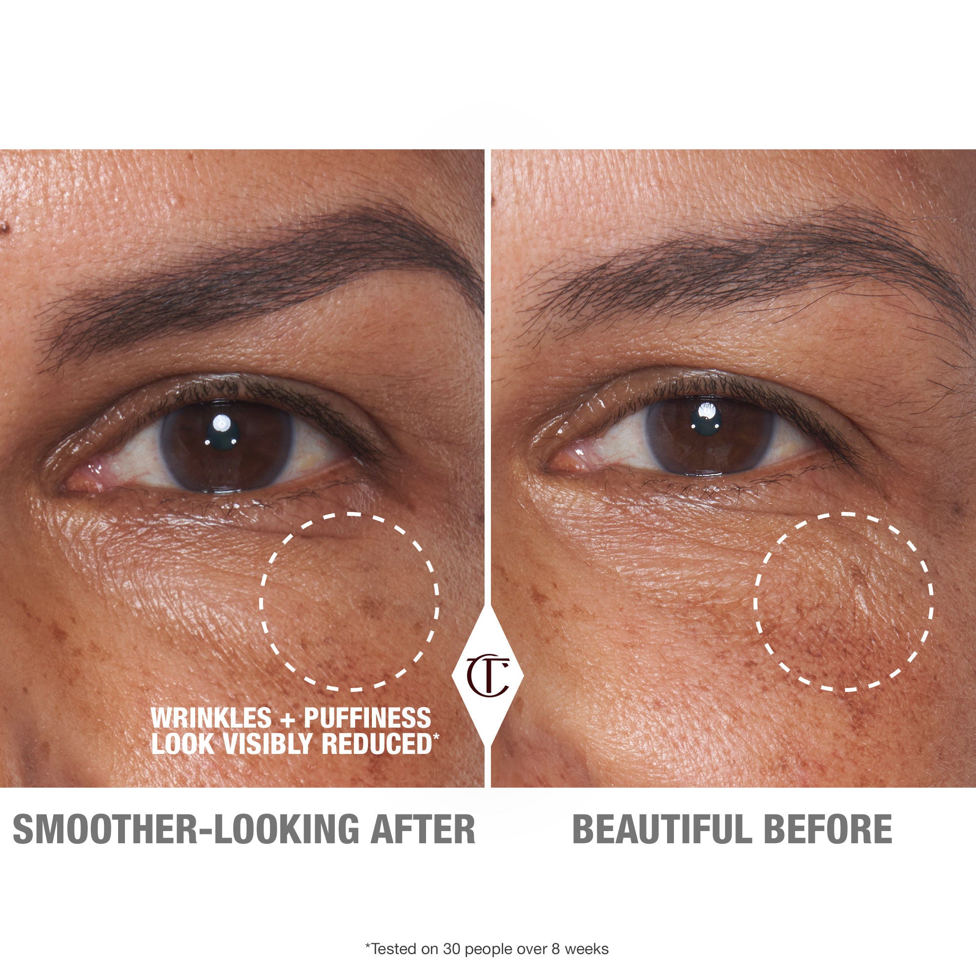 Best Cryo Recovery Eye Serum for Dark Circles & Puffiness - Anti-Aging Under Eye Treatment for Women & Men - Perfect for Morning & Night Skincare Routine