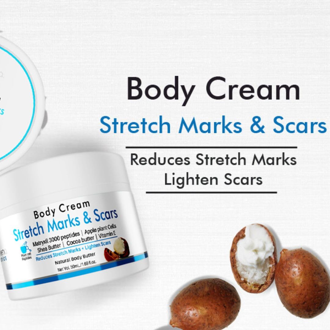 Volamena Stretch Marks & Scars Removal Cream - 50ml Moisturizing Body Lotion for Pregnancy, Weight Loss & Skin Repair - Perfect for Postpartum Care & Daily Hydration