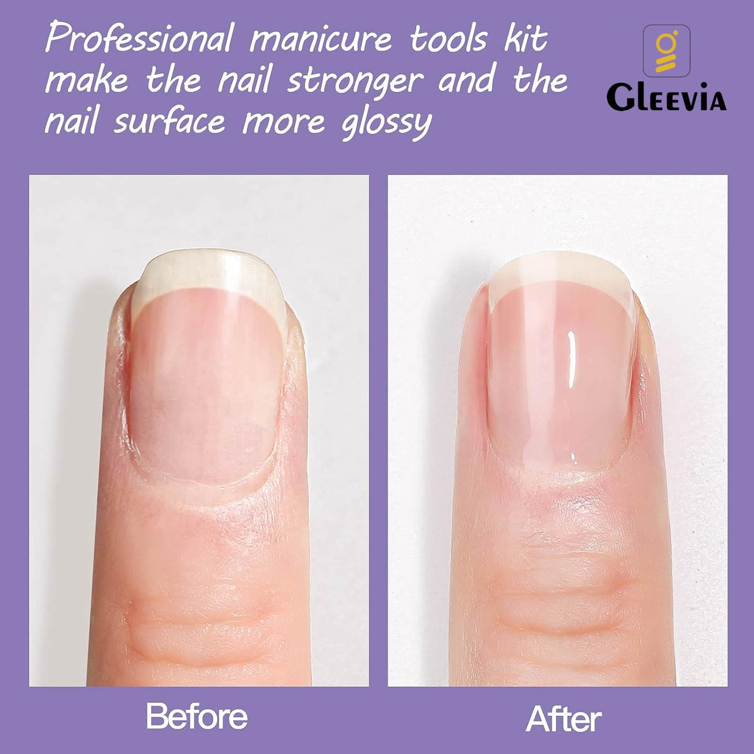 Gleevia Cuticle Oil & Softener Combo Pack - 2Pcs Nail Care Set for Dry, Damaged Cuticles | Nourishing & Moisturizing Treatment to Strengthen & Revitalize Nails | Perfect for Manicures, At-Home Nail Care & Professional Salons (15ml Each)