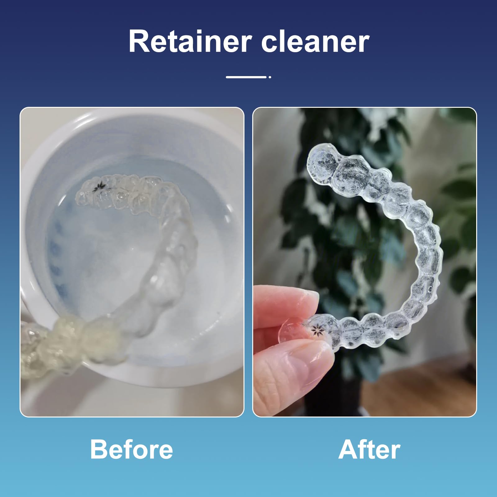 Invisalign Retainer Cleaner Tablets - 30 Count (1 Month Supply) for Aligners, Night Guards & Dentures - Removes Stains, Odors & Plaque - Perfect for Travel & Daily Dental Care