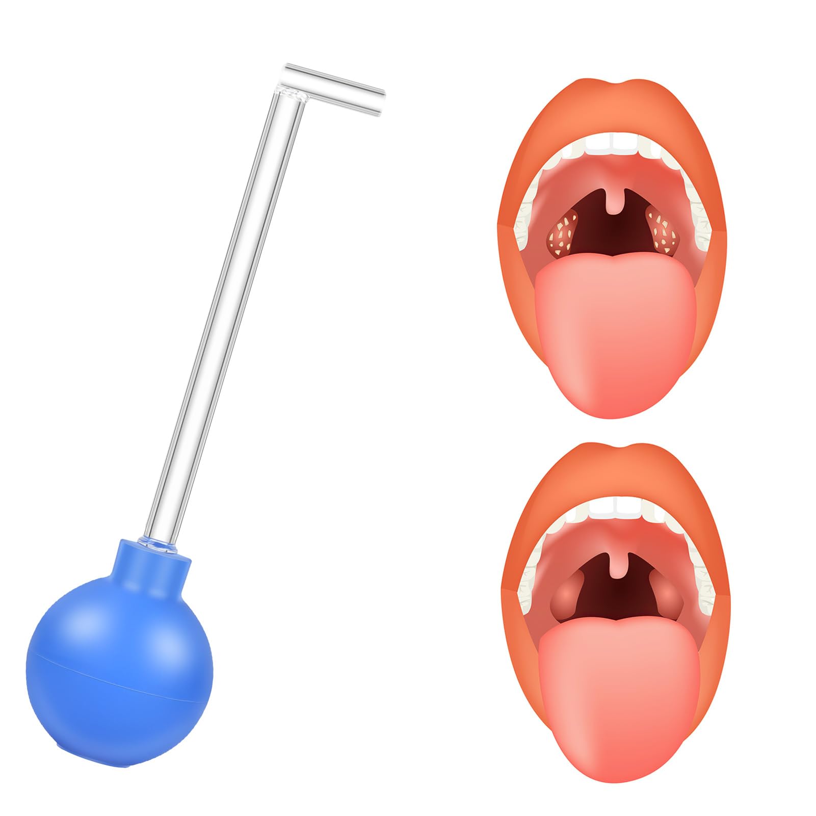 **Tonsil Stone Remover Kit - Manual Vacuum Cleaner for Tonsil Stones, Oral Hygiene & Bad Breath Relief - Blue (1Pc) - Perfect for Home Use & Travel Dental Care**