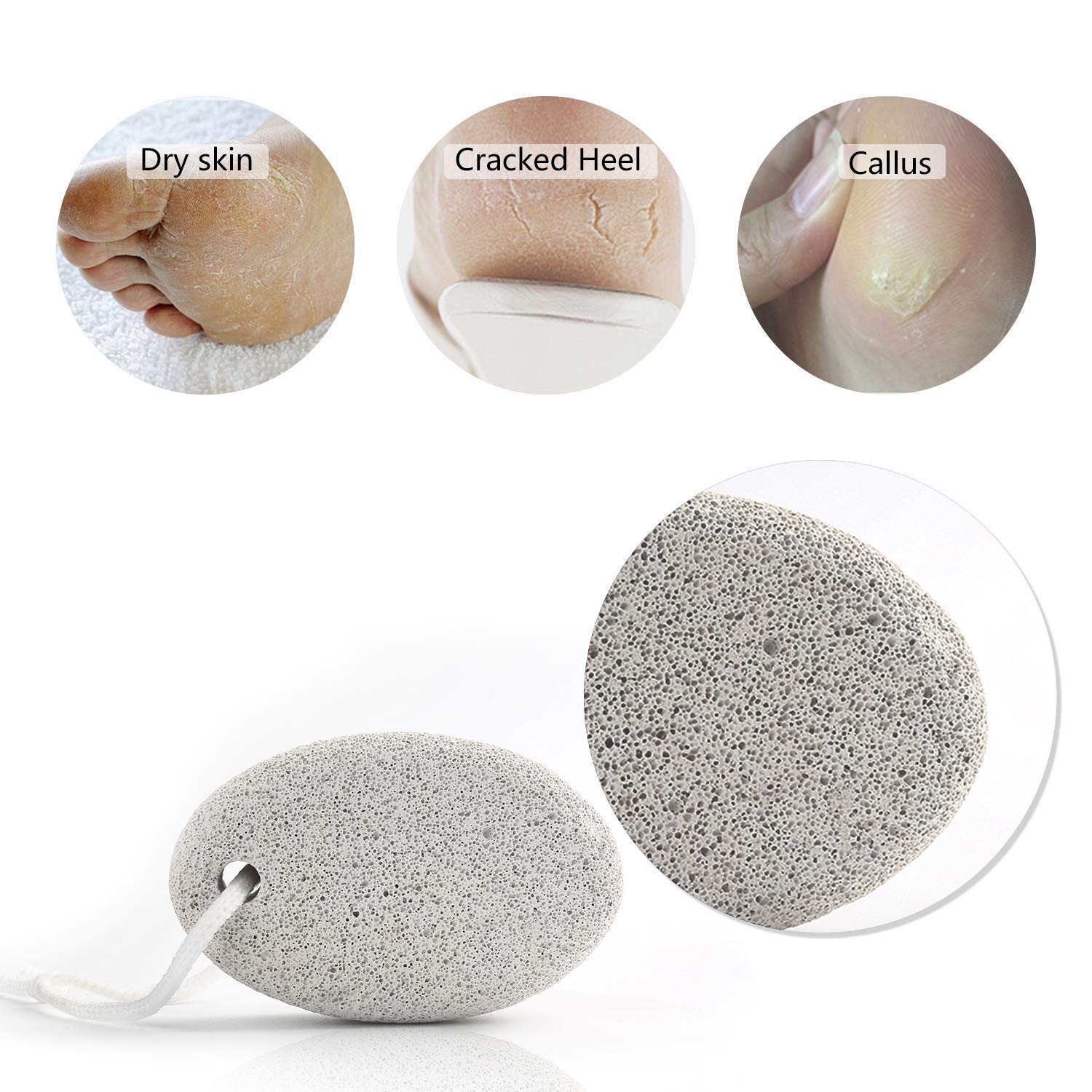 Premium Oval Pumice Stone for Dead Skin Removal - Callus & Cracked Heel Exfoliator for Men & Women - Perfect for Pedicures, Foot Care & At-Home Spa Treatments