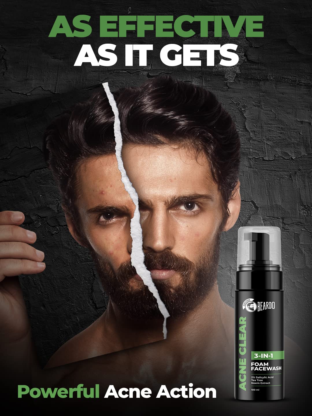 Beardo Acne Clear Foam Face Wash for Men - 100ml | 3-in-1 Acne Treatment with 2% Salicylic Acid | Oil-Free & Pimple Control | Perfect for Daily Skincare Routine & Gym Aftercare