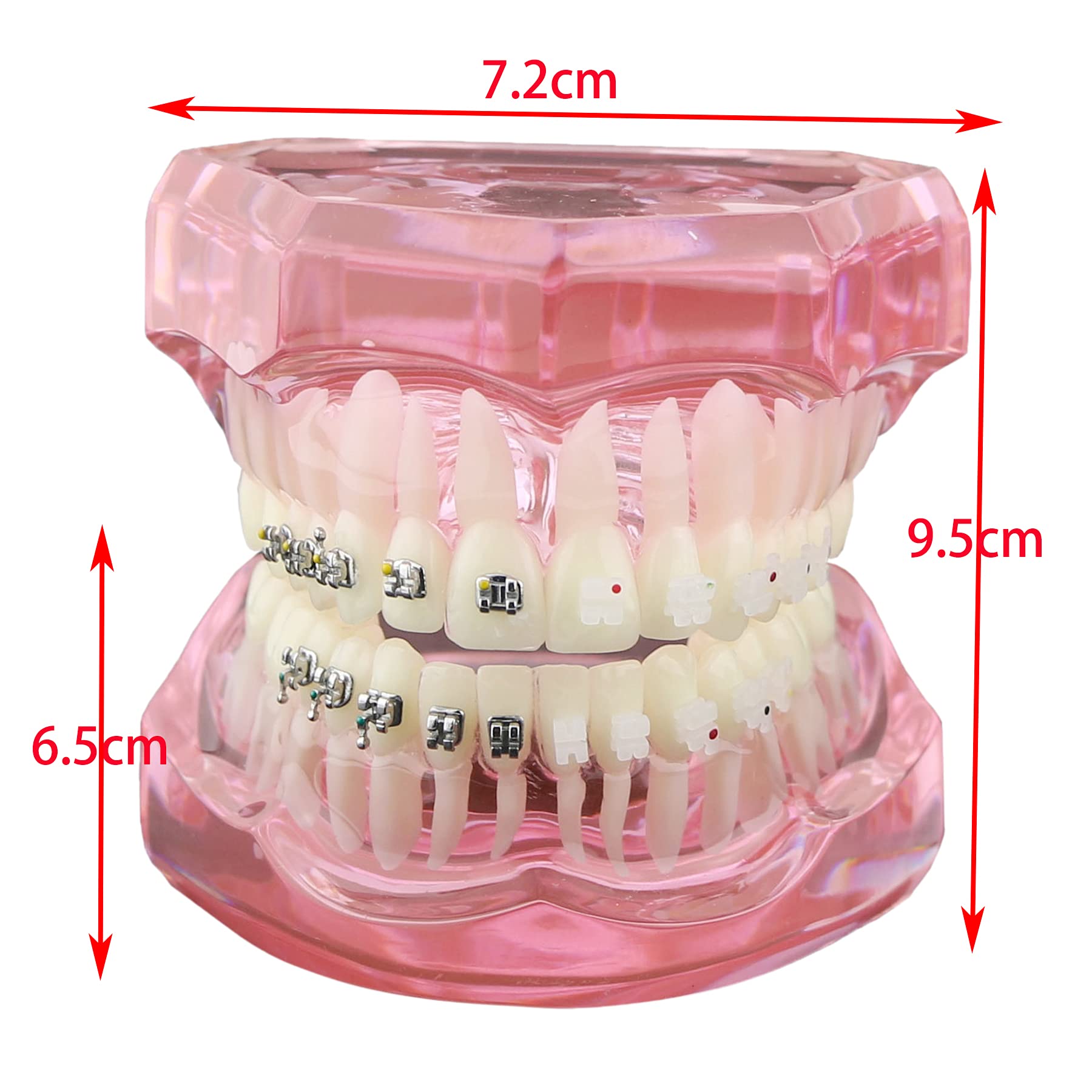 Dental Orthodontic Teeth Model with Metal & Ceramic Brackets - Professional Study Teeth Model for Dentists, Students & Orthodontic Training | Perfect for Dental Education, Practice & Office Display