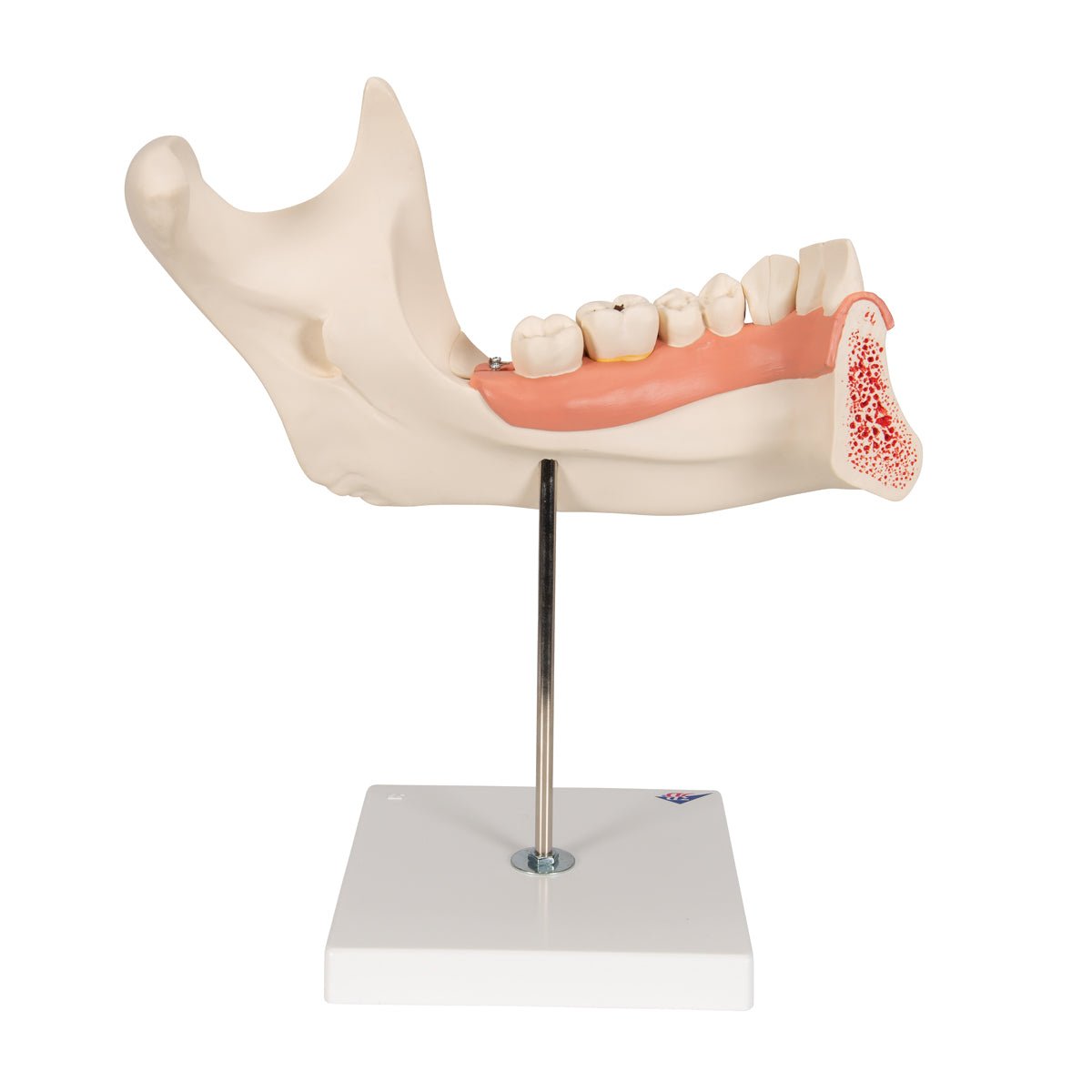 Half Lower Jaw Model - 3X Full Size, 6-Part Dental Anatomy Demonstration for Dental Students & Professionals | Perfect for Classroom Teaching & Medical Study