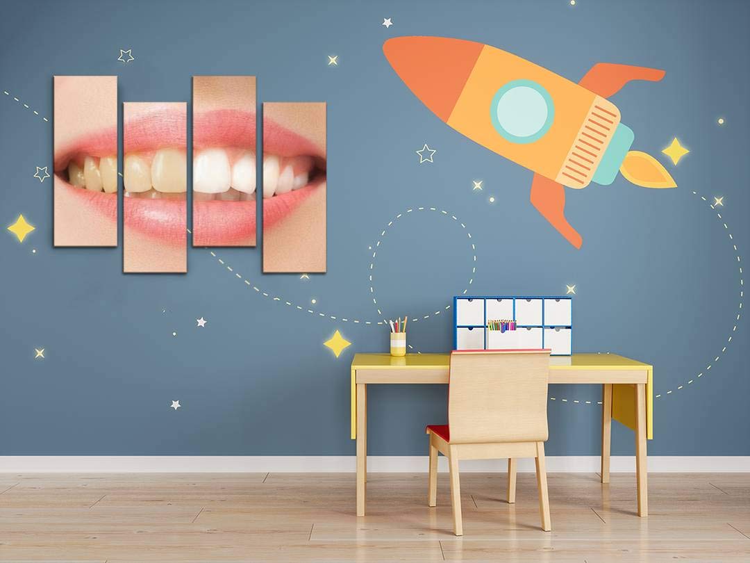 Wocatton Teeth Whitening Before and After Wall Art - Stretched Canvas Print with Frame - Perfect for Dental Office, Bathroom Decor & Home Decoration - Modern Abstract Teeth Painting for Living Room