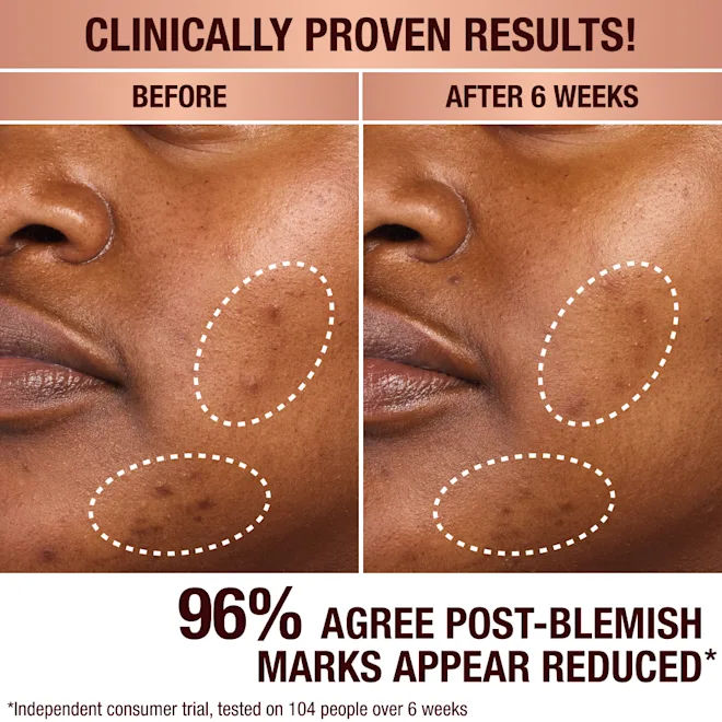 Dark Spot Correcting Radiance Recovery Serum for Face - Brightening & Even Skin Tone Treatment - Perfect for Daily Skincare Routine & Hyperpigmentation Care