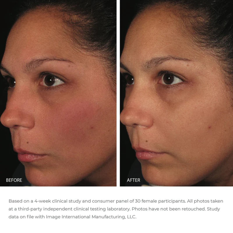 IMAGE Skincare Ormedic Balancing Antioxidant Serum - Hydrating Facial Serum for Sensitive Skin | Reduce Redness & Improve Skin Texture | Perfect for Daily Skincare Routine & Post-Treatment Care