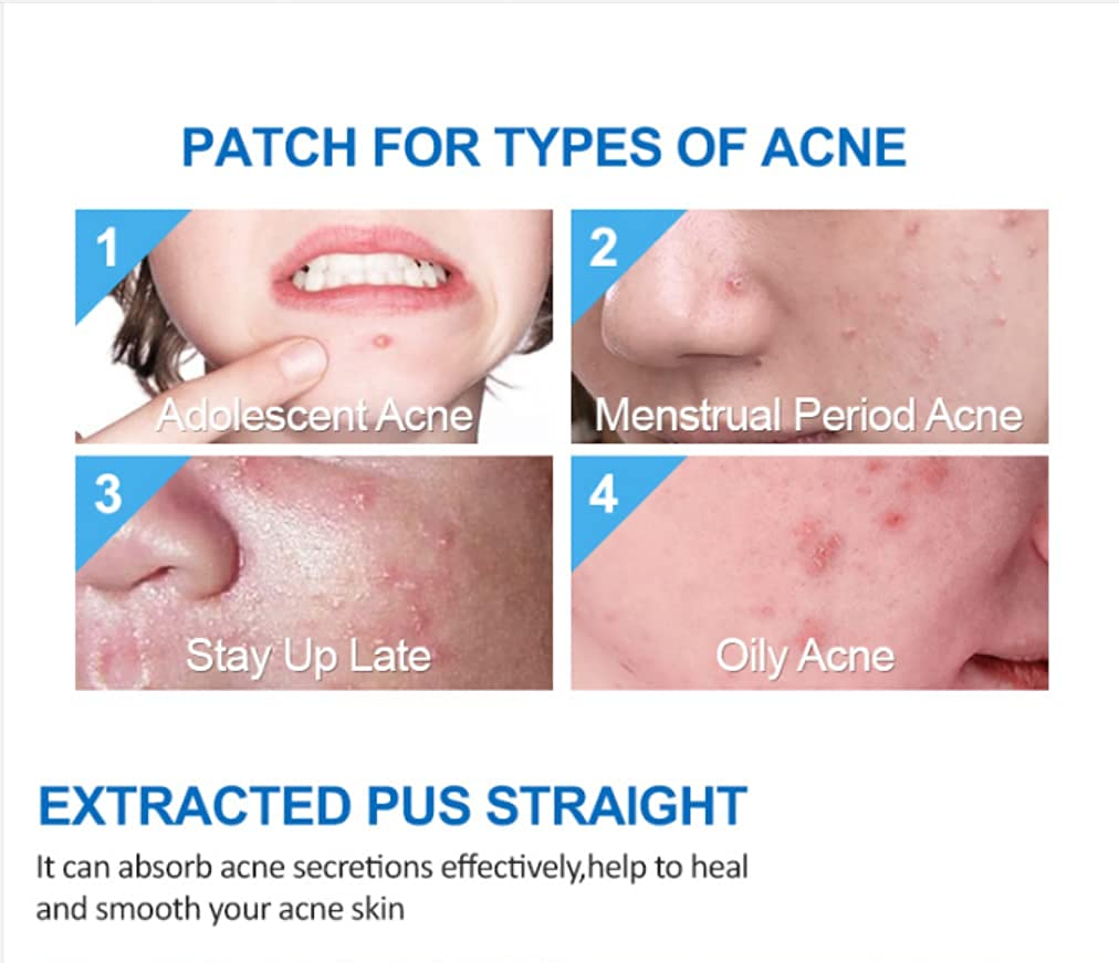 Hydrocolloid Acne Pimple Patches - 108 Count Invisible Absorbing Cover for Face & Skin Care | Spot Treatment for Breakouts, Blemishes & Zits | Perfect for Overnight Use & Daily Skincare Routine
