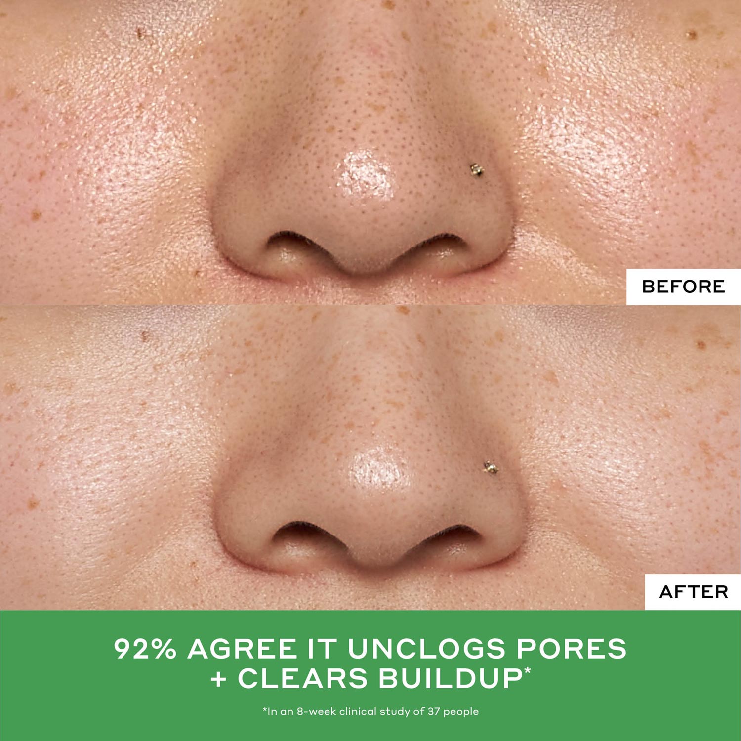 2% Salicylic Acid Detox Toner for Acne & Blackheads - Gentle Exfoliating Face Toner for Oily & Combination Skin | Perfect for Daily Skincare Routine & Post-Workout Cleansing
