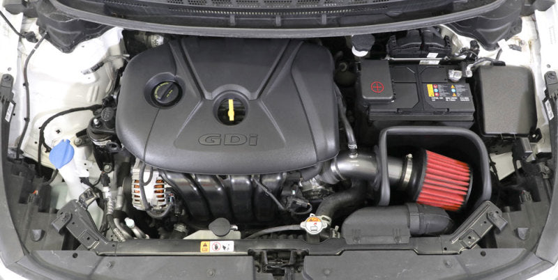 AEM 17-18 Kia Forte L4 2.0L Fuel Injected Cold Air Intake System - Performance Upgrade for Better Acceleration & MPG